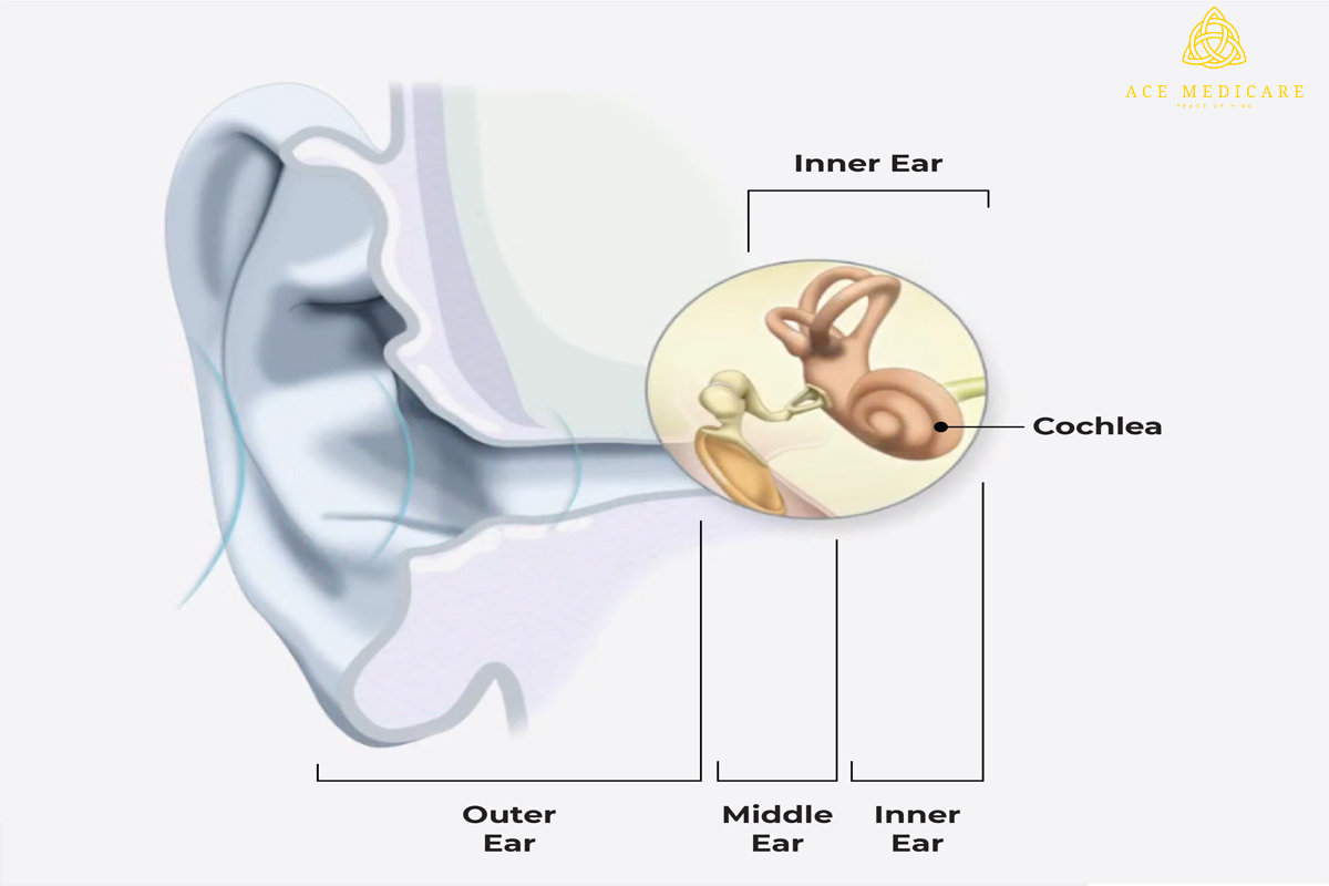 Tips for a Successful Recovery and Rehabilitation After Middle Ear Transplant Surgery